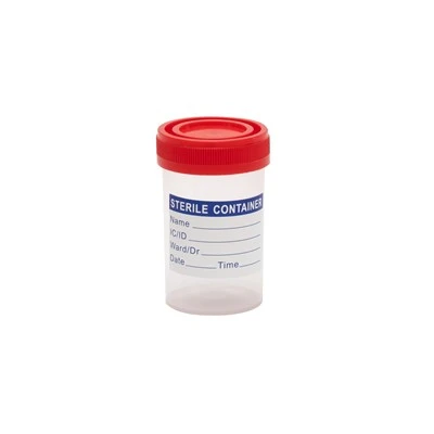 Urine Specimen Container Urine Specimen Container